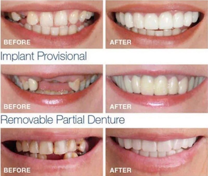 ✅ La sonrisa de tus sueños está a solo un clic de distancia! ✅