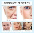 HOYGI Skin-Firming ™ | Crema Reafirmante