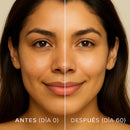 Recupera Tu Rostro en Días: Kit Anti-Edad 3 en 1 – Paga 1 y Lleva 3 🧴🧴🧴